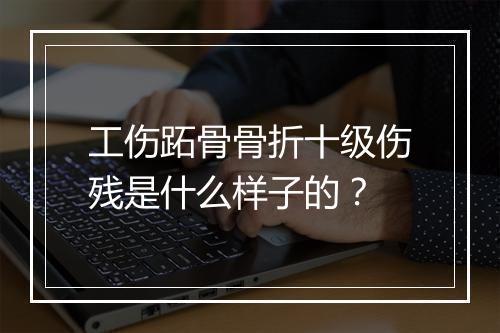 工伤跖骨骨折十级伤残是什么样子的？