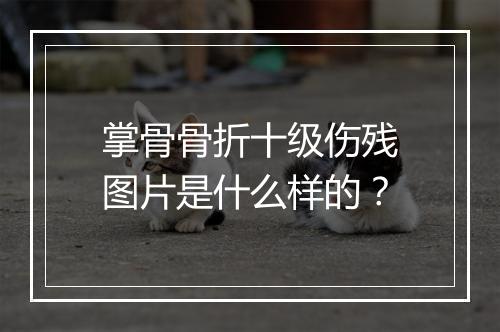 掌骨骨折十级伤残图片是什么样的？
