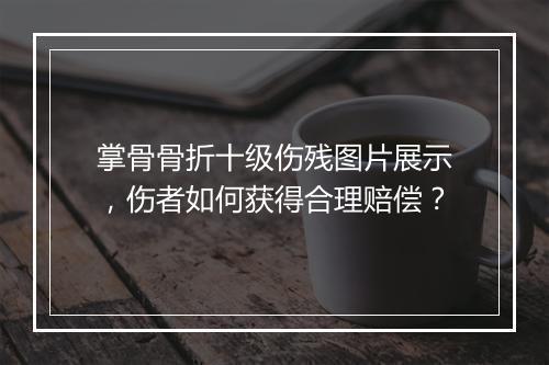 掌骨骨折十级伤残图片展示，伤者如何获得合理赔偿？