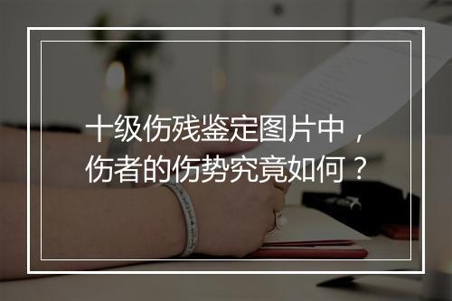 十级伤残鉴定图片中，伤者的伤势究竟如何？