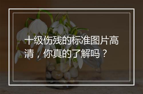 十级伤残的标准图片高清，你真的了解吗？
