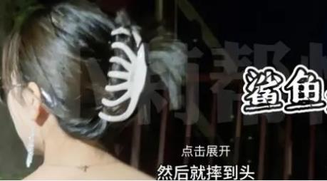 鲨鱼夹是有危害的！女子头戴鲨鱼夹摔倒后成植物人